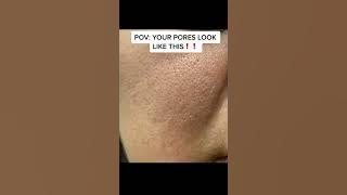 Do you PORES LOOK THIS LARGE?!!!! #skincareroutine #skincare