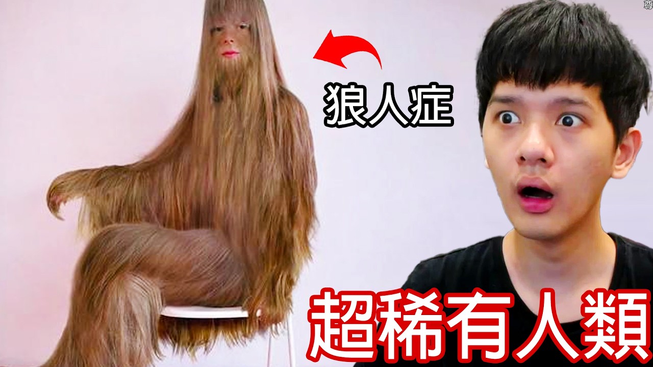 【尊】他們就是擁有0.001%罕見基因的「超稀有人類」! ? 下次進化可以記得帶上我嗎...? ?【第二頻道】