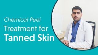 Transform Your Skin Proven Chemical Peel Treatment for Tanned Skin at Oliva Skin &amp; Hair Clinic