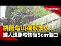 桃園龜山獼猴襲人! 婦人遭撕咬慘留5cm傷口｜#寰宇新聞 @globalnewstw