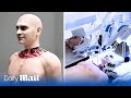 World&#39;s FIRST head transplant system has been unveiled