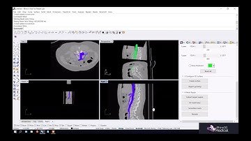 Tutorial: Segmentation (Region growing)
