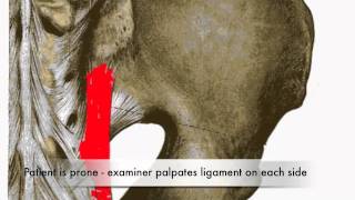 Provocation of Long Dorsal Sacroiliac Ligament Test (CR)