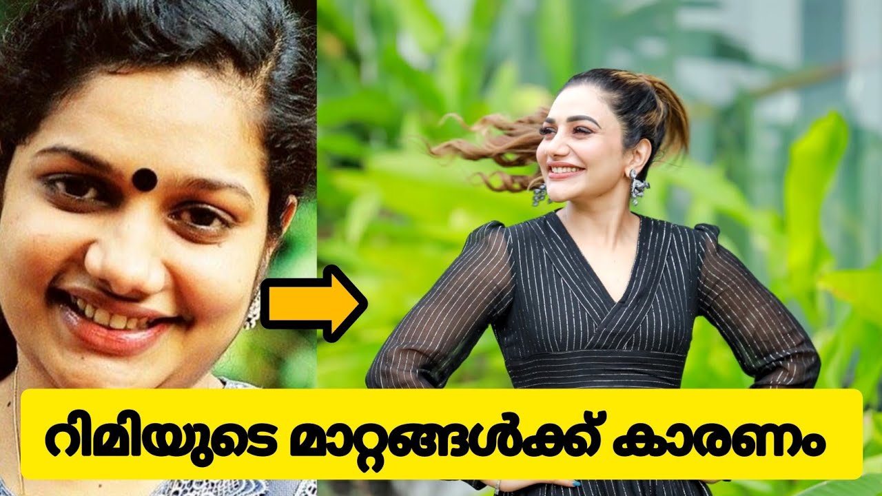 കേട്ടാൽ ഞെട്ടും 😱റിമി ടോമിയുടെ യഥാർത്ഥ ജീവിതം |  Divorce 