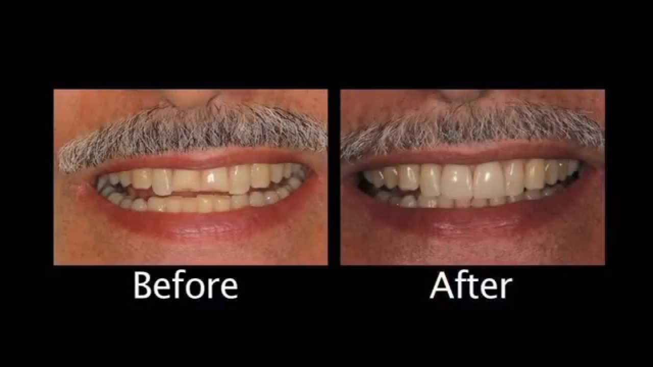 How To Find A Cosmetic Dentist In Northridge - (818) 714-8940