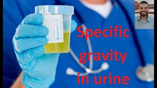 تحليل الكثافة النوعية في البول specific gravity in urine