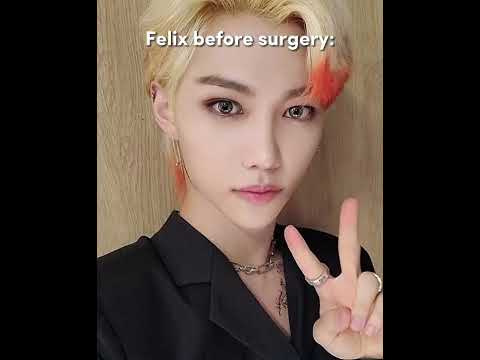 Felix Before Surgery Straykids Shorts