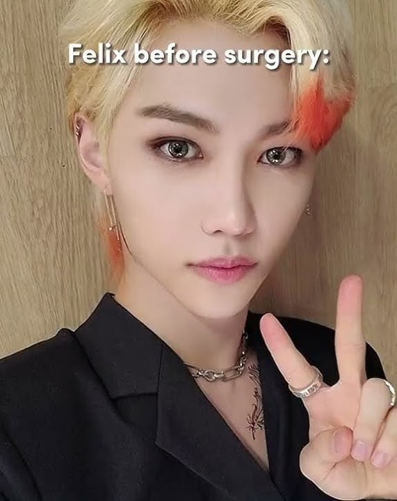 Felix before surgery 🤍 #straykids #shorts