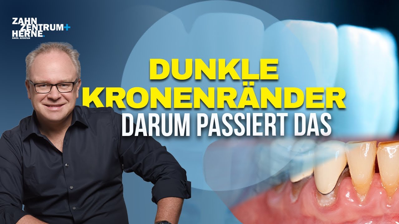 Dunkle Kronenränder an Frontzähnen – warum sie entstehen und was heute besser ist