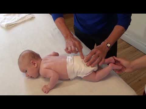 Video: Hvid Tunge På Baby: Trast Og Andre årsager Plus Behandling