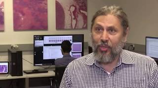 AI system more accurately identifies collapsed lungs using chest x-rays | CTV News