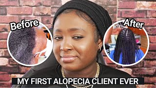 My First Alopecia Client - Unbelievable Hair Transformation - Did it Work?