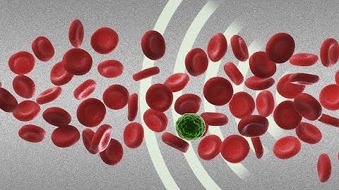 Detecting rare cancer cells with sound waves