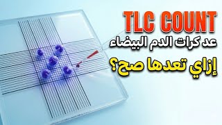 👉 "TLC Manual Count 🔬 إزاي تعد كرات الدم البيضاء صح خطوة بخطوة!"