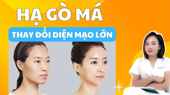 Gọt hàm hạ gò má giá bao nhiêu năm 2024