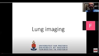 BNMS Talk - Lungs