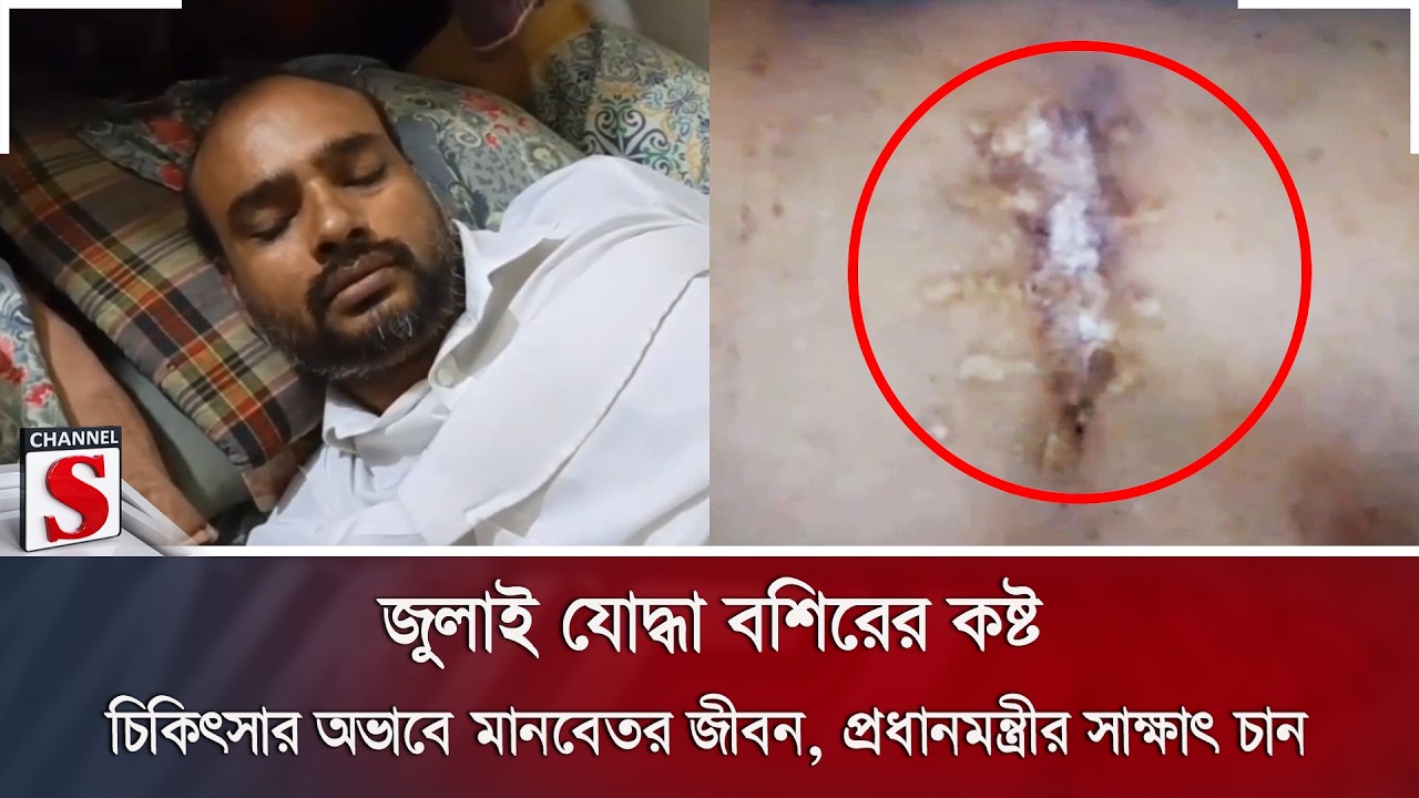জুলাই যোদ্ধা বশিরের কষ্ট; চিকিৎসার অভাবে মানবেতর জীবন, প্রধানমন্ত্রীর সাক্ষাৎ চান | Channel S News