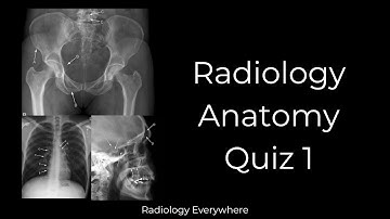 Radiology Anatomy Quiz 1 #radiologytutorials #radiology