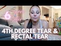 4th degree tear from childbirth  6 years later