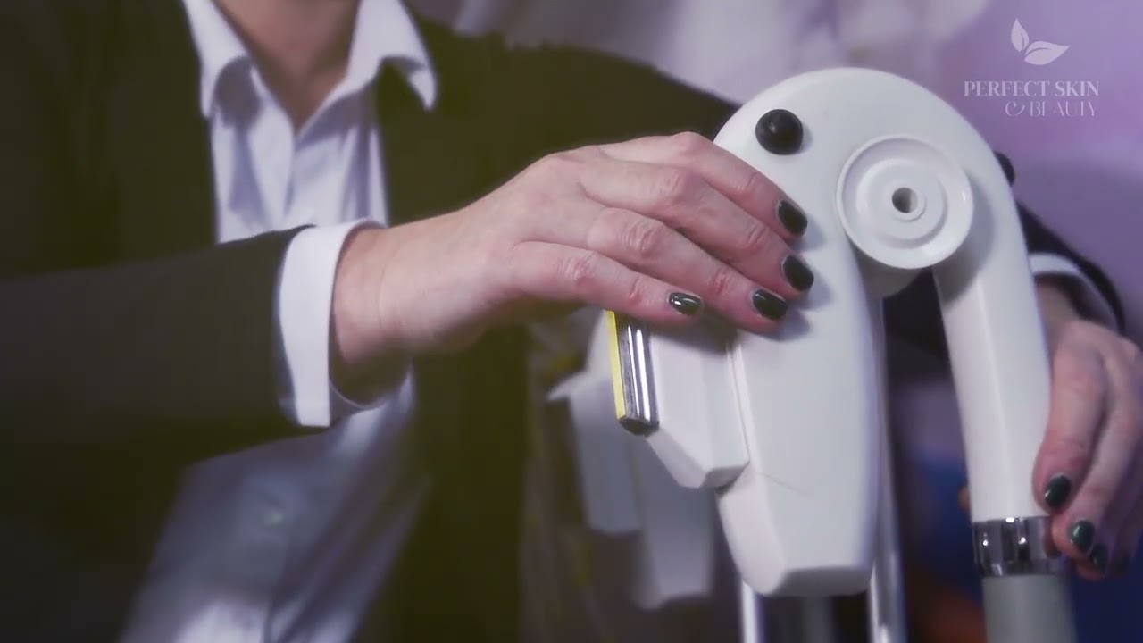 Definitief ontharen middels IPL