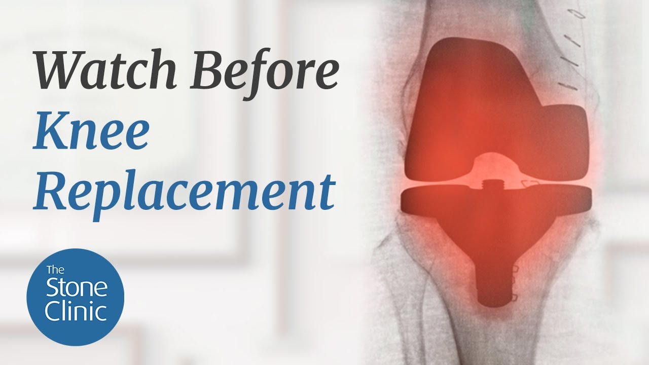 You Likely Don't Need A Knee Replacement (80% Don't) - YouTube