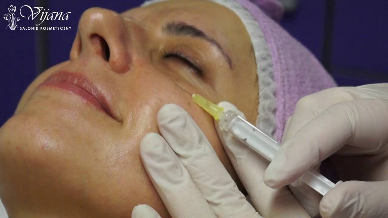 Mezoterapia igłowa na okolicę oczu - Salonik kosmetyczny Vijana