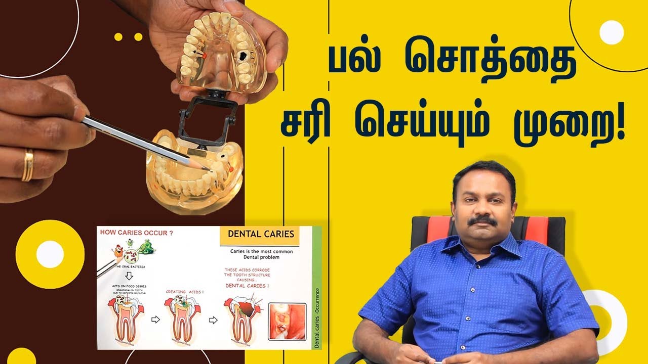 Treatment for Tooth cavity in Tamil பல் சொத்தை ஏற்பட காரணம்? அதற்கான