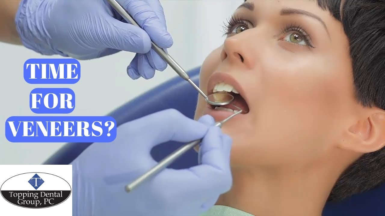 Veneers In Middlebury Indiana