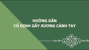 Hướng dẫn cố định gẫy xương cánh tay | Bệnh viện Quân y 103