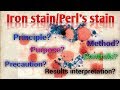 Perls stainiron stainprussian blue reactionhematologyspecial stainstar laboratory