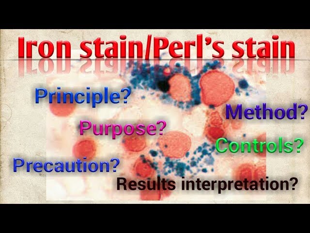 Perl's stain/Iron stain/Prussian Blue Reaction/Hematology/Special stain/STAR LABORATORY class=