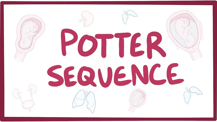 Potter sequence (oligohydramnios...  - causes, sym...
