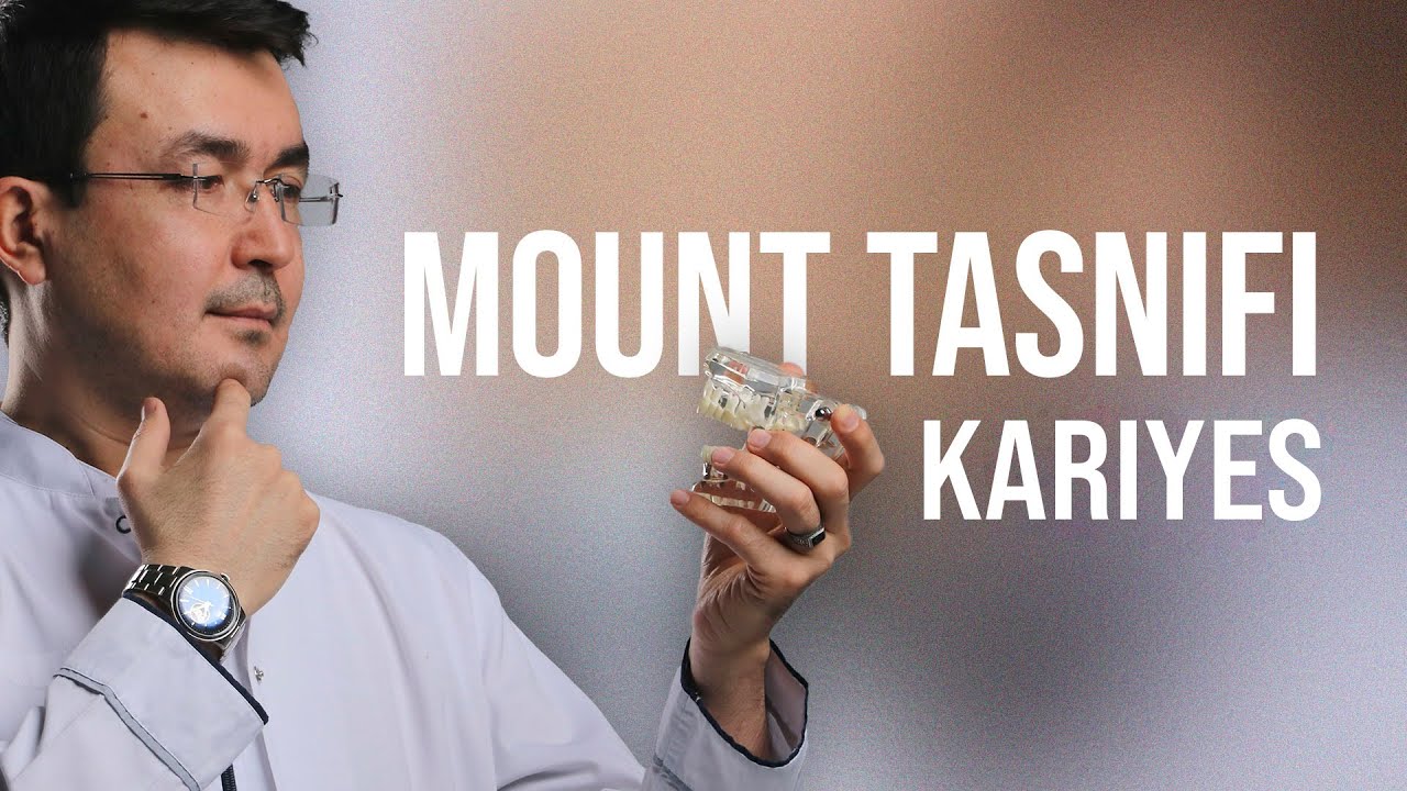 Maunt tasnifi (kariyes)