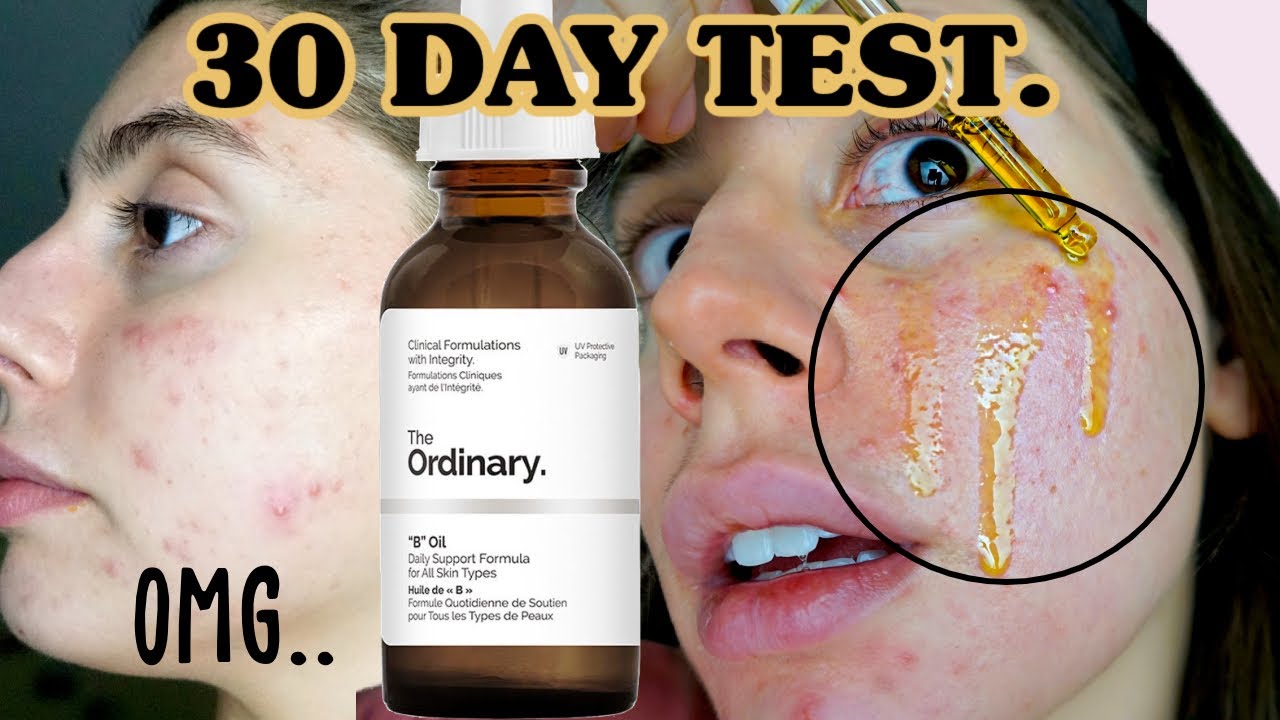 ONE MONTH TEST OF THE 