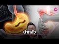 3 พฤติกรรมที่เสี่ยงทำลายกระเพาะอาหาร: ป้องกันมะเร็งกระเพาะอาหารได้ยังไง?