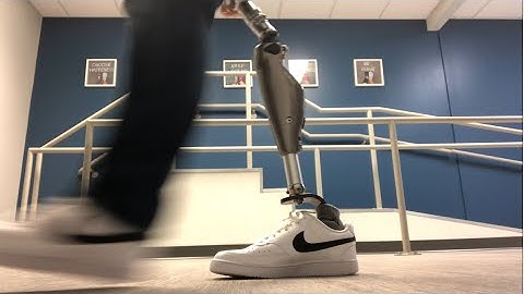 Hip disarticulation prosthetic gait demonstration 2022