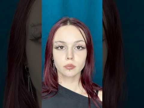 Подбородок филлером #косметологростов #косметологмосква #beforeandafter #лифтингмосква
