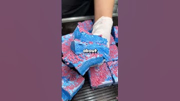 Anesthesiologist, what was something you won