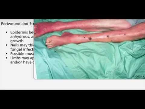 Arterial Wounds - YouTube