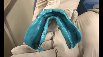 Final Impressions for Complete Dentures