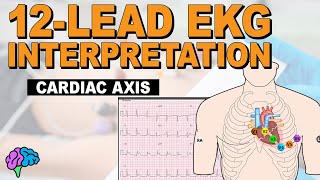 Understanding Cardiac Axis and Deviations  12Lead EKG