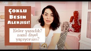 Çoklu Besi̇n Alerji̇si̇ Nasil Bi̇r Süreç Yaşadik Tavsi̇yeler