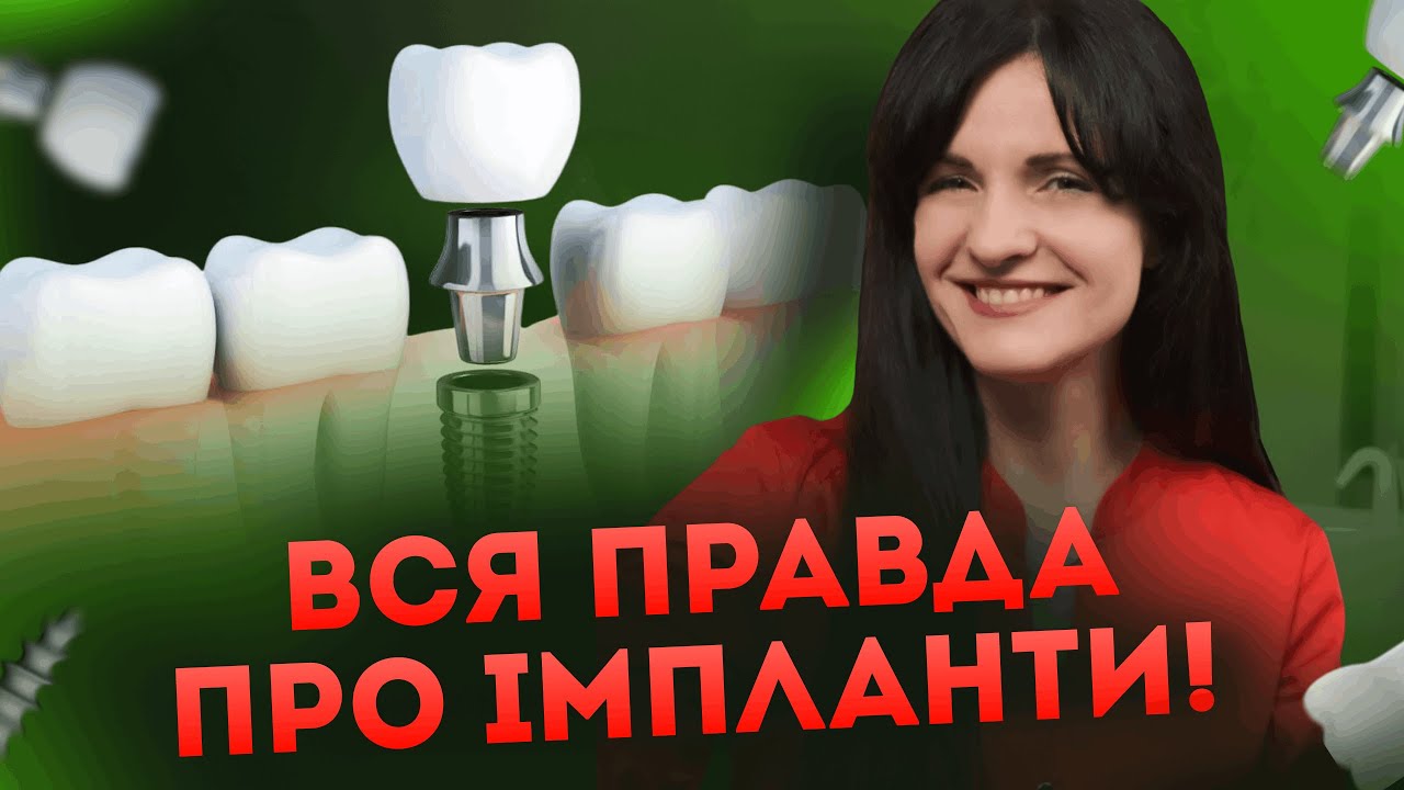 Ніколи не став ЦІ імпланти!  ВСІ ВИДИ імплантів в 1 відео!