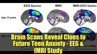 Brain Scans Reveal Clues to Future Teen Anxiety - EEG & fMRI Study