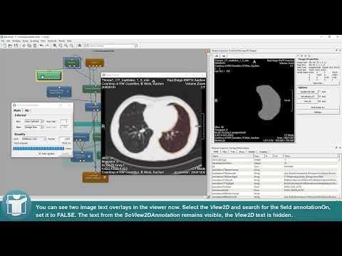 MeVisLab Tutorials - Contours - Calculate the Volume of Contours