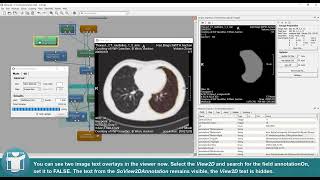MeVisLab Tutorials - Contours - Calculate the Volume of Contours