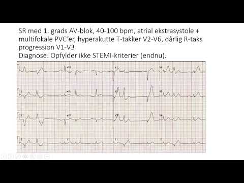 Video: Akutt Hjerteinfarkt: Årsaker, Symptomer Og Behandling