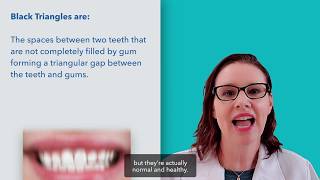 What Are Black Triangles?