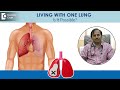 Can You Live With One Lung DAMAGED LUNG One Lung Capacity Dr Hirennappa B Udnur Doctors Circle Can You Live With One Lung DAMAGED LUNG One Lung Capacity Dr Hirennappa B Udnur Doctors Circle