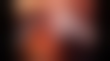 Robotic assisted Total Gastrectomy with D2 LN Dissection